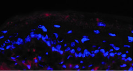 Microscope image of mucous membrane showing antibodies in red.