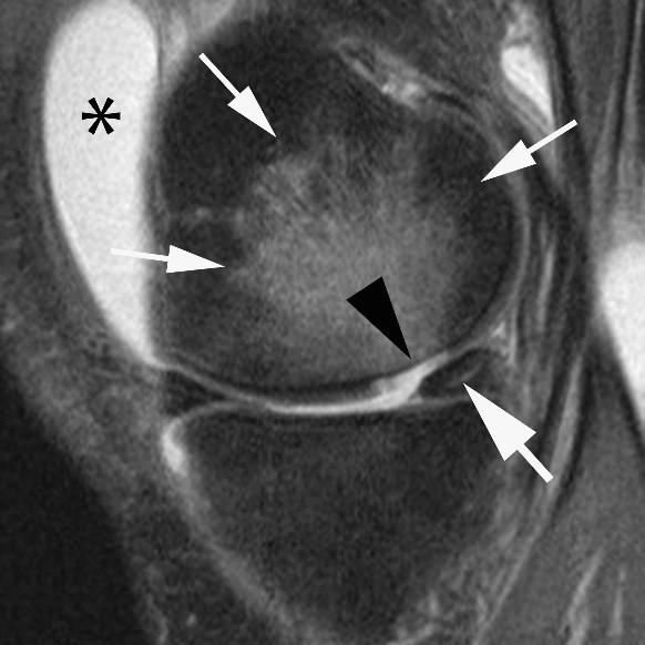 MRI image of a knee.