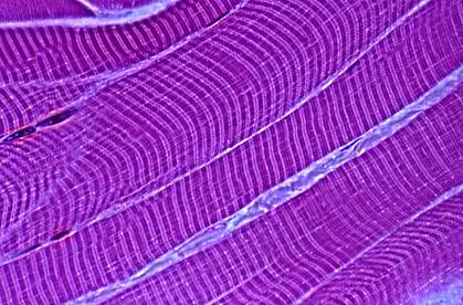 muscle fibers