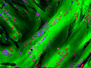 Skeletal muscle fibers