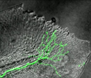 Regenerating Nerve Fibers