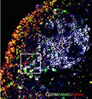 Joint tissue from patients with rheumatoid arthritis.