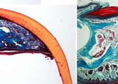 Mouse toe tips can regenerate within five weeks of being clipped (left) unless the Wnt signaling pathway is inactivated (right).