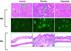 Image of skin and kidney cells treated and untreated with tofacitinib