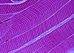 muscle fibers