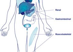 Anatomical illustration showing parts of the body which might be affected by lupus