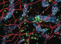 Microscope image showing cells (in color) that drive inflammation in psoriasis.