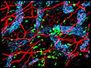 Sensory Neurons and Dendritic Cells in Mouse Skin