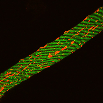 Live Pompe Muscle Fiber