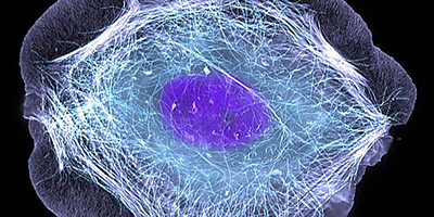 This normal human skin cell was treated with a growth factor that triggered the formation of specialized protein structures that enable the cell to move