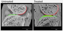 X-rays of mice comparing treated and untreated knee joints