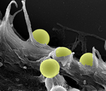 nanospheres